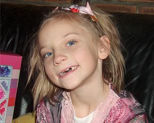 alise